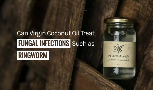 Can Virgin Coconut Oil Treat Fungal Infections Such as Ringworm