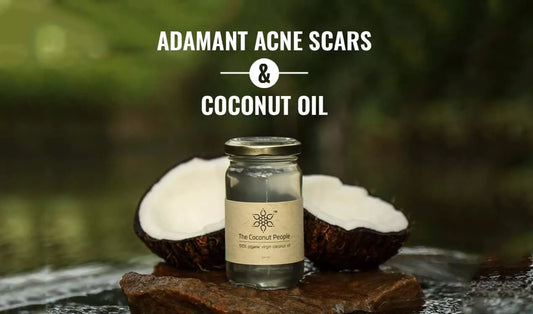 Adamant Acne Scars & Coconut Oil