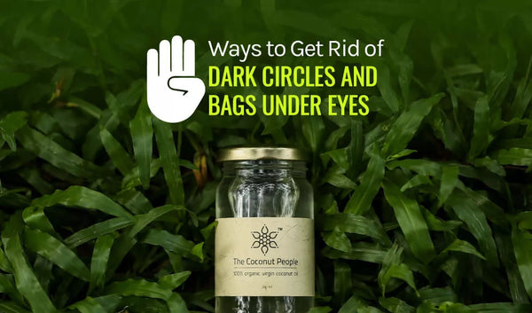 4 Ways to Get Rid of Dark Circles and Bags under Eyes
