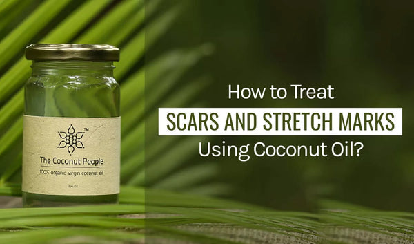 How to Treat Scars and Stretch Marks Using Coconut Oil?